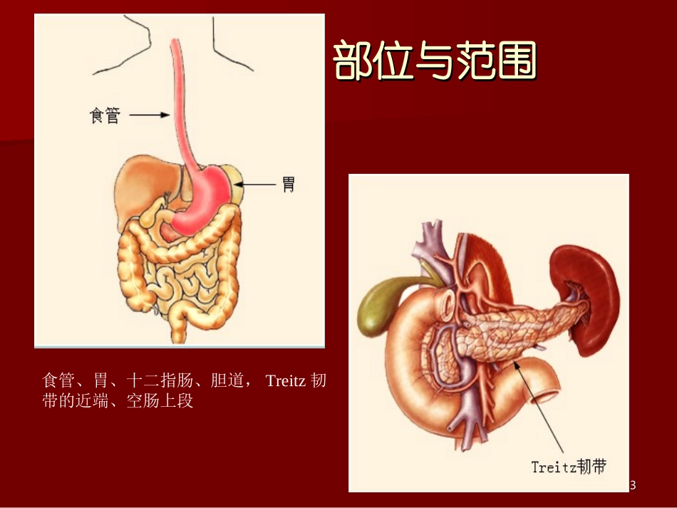 上消化道出血33_第3页