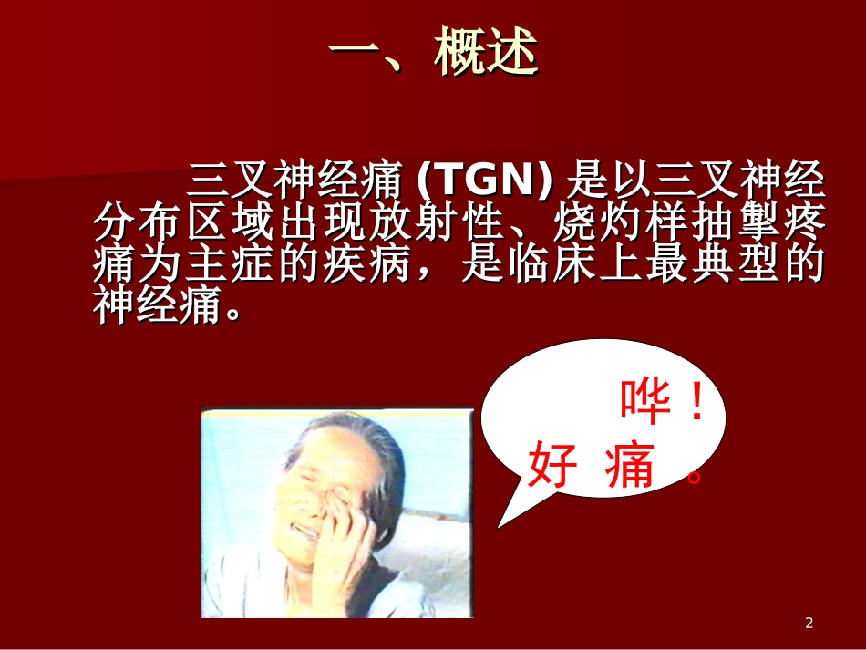 三叉神经痛详解_第2页