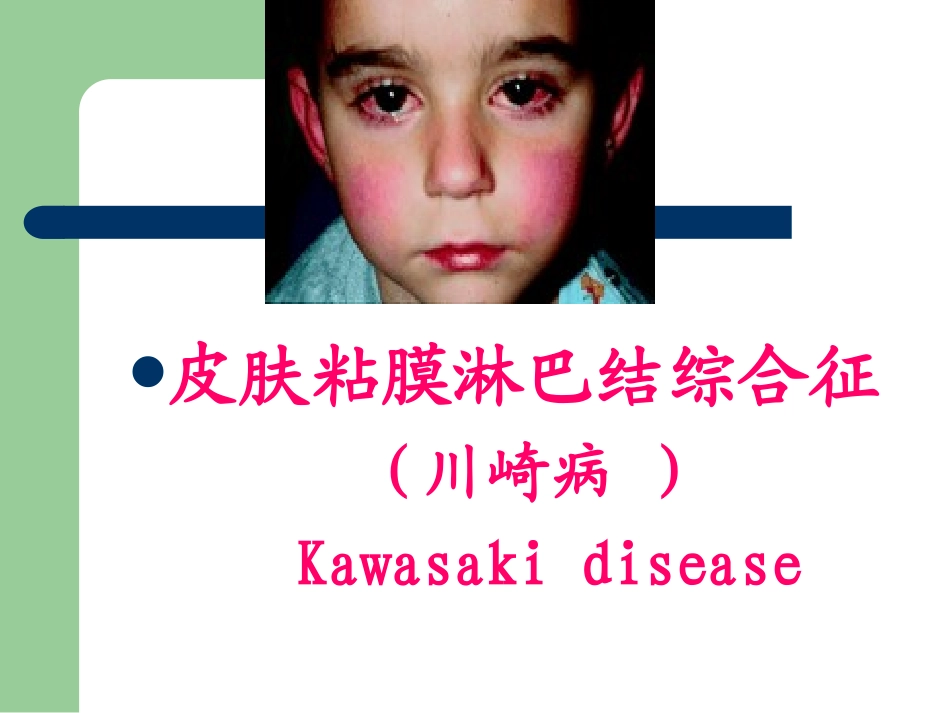 【PPT】川崎病._第1页
