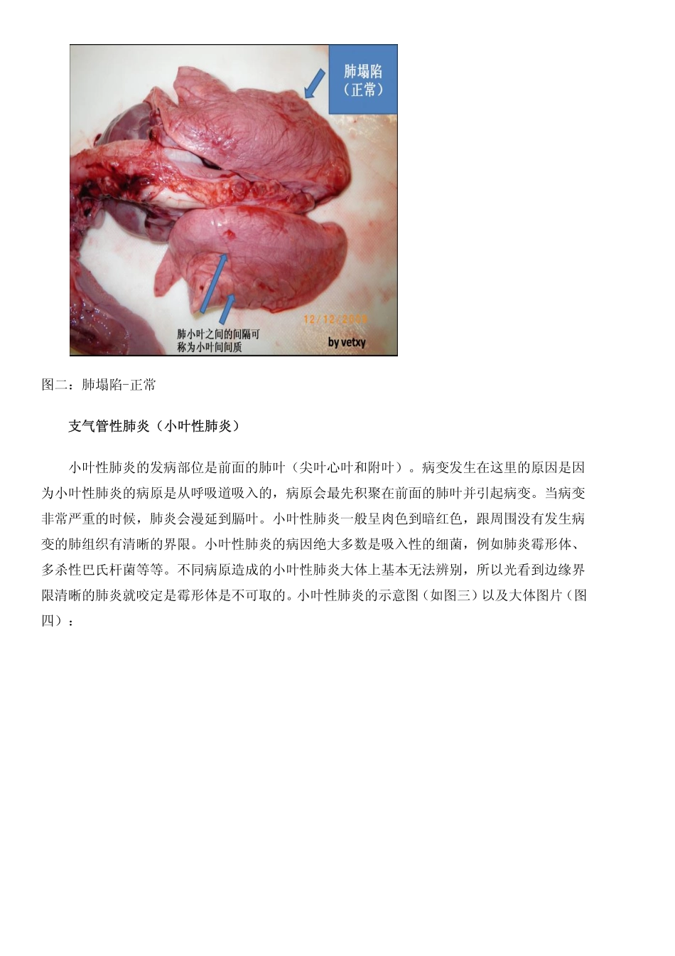 《畜牧人》杂志推荐经典文章：猪常见的肺部大体病变_第2页
