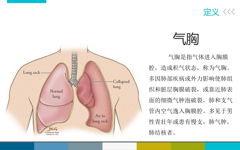 Ⅱ型呼衰合并气胸个案2_第3页