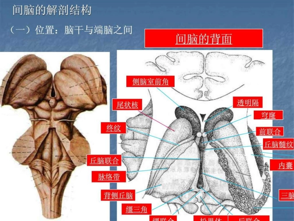 [精品]间脑病变的定位诊.ppt_第3页