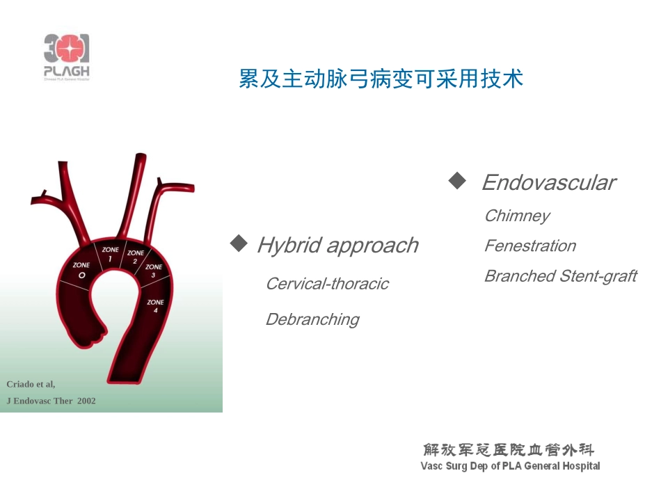 [精品]主动脉弓复杂病变--HybridChmneyorelse_第2页