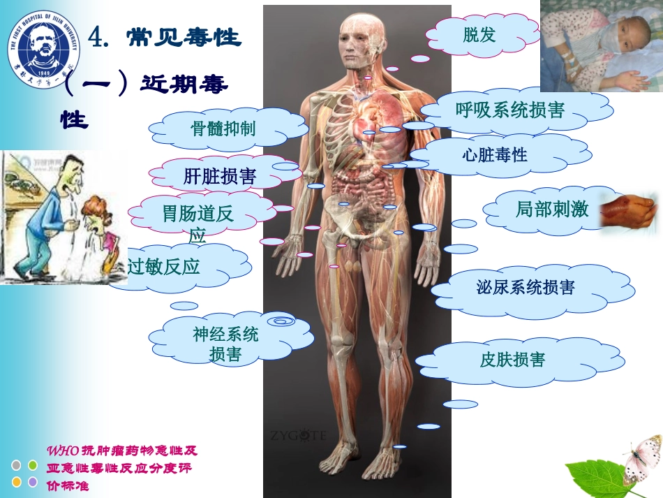 ZCZ-化疗常见毒副反应及处理_第2页