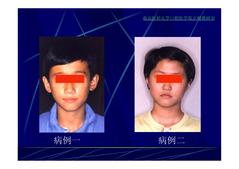 X线投影测量_第2页