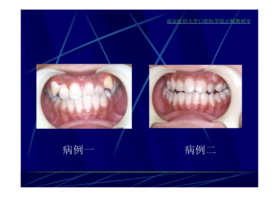 X线投影测量_第3页