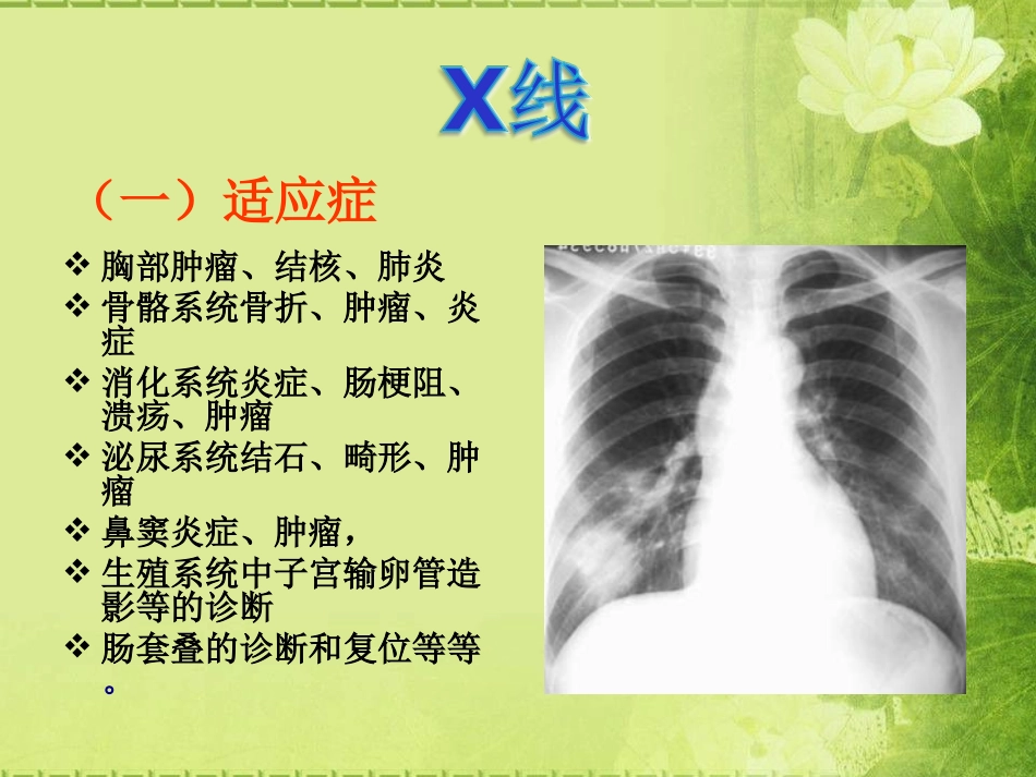 X线CT-DSA--MRI-PETCT-超声的适应症禁忌优势及缺点_第1页