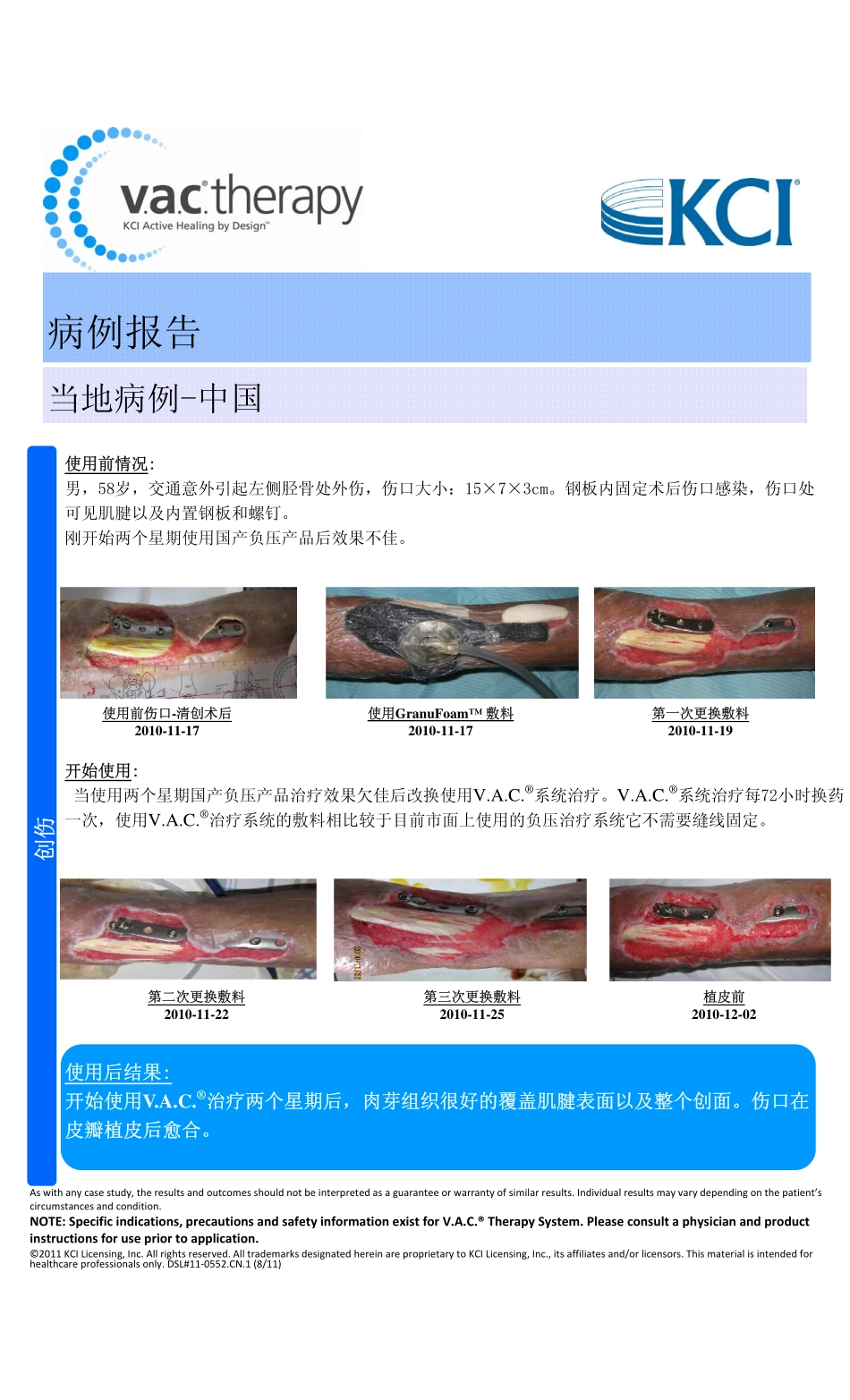 V.A.C._第2页