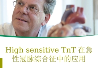 TnT在急性冠脉综合征中的应用