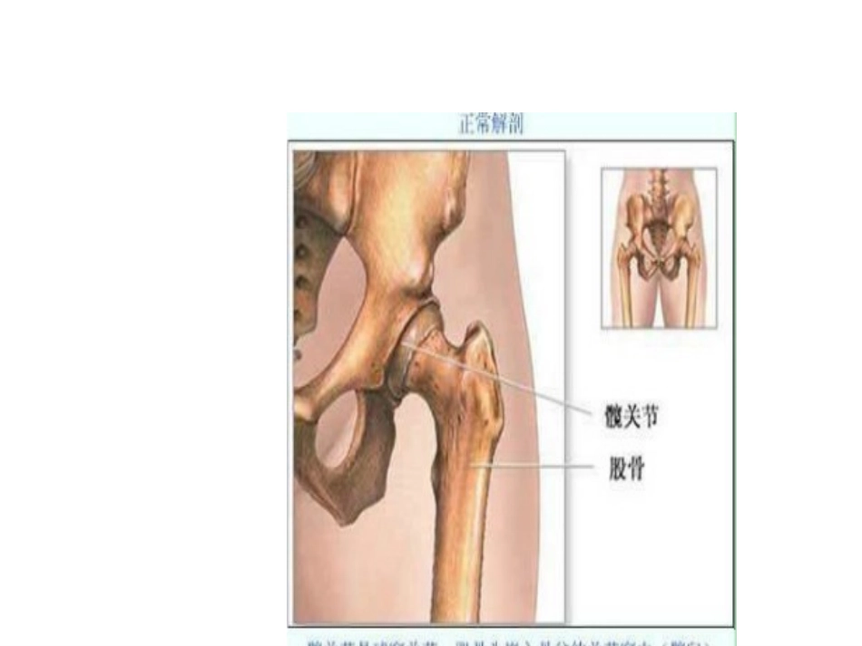 THA-术后PPT_第3页