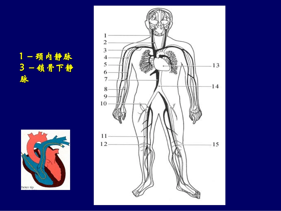 Swan-Ganz导管置入术_第2页