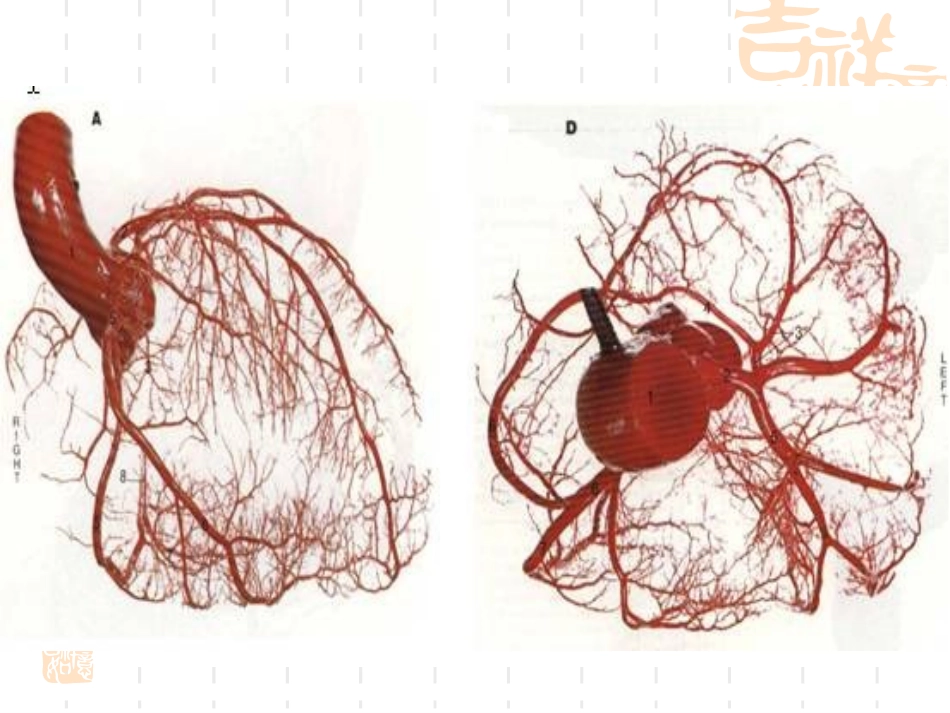 STEMI心电图识别和急诊PCI_第3页