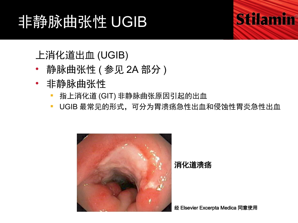 SST-非静脉曲张性上消化道出血7_第2页