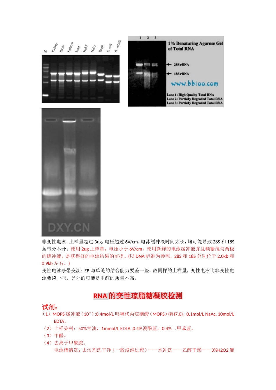 RNA的变性电泳原理_第2页