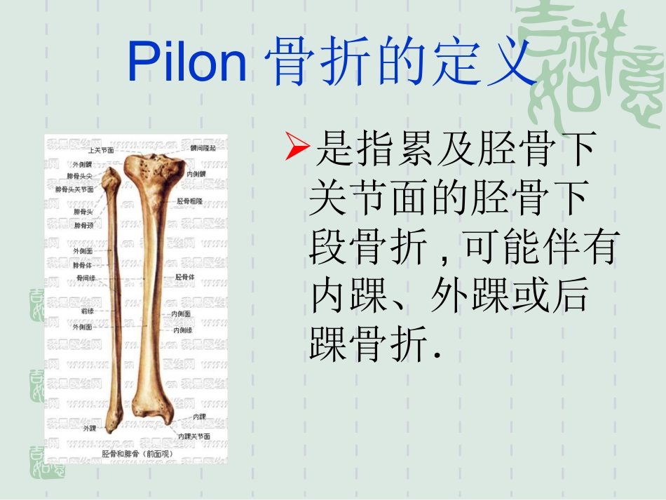 Pilon骨折的诊治现状与进展_第2页