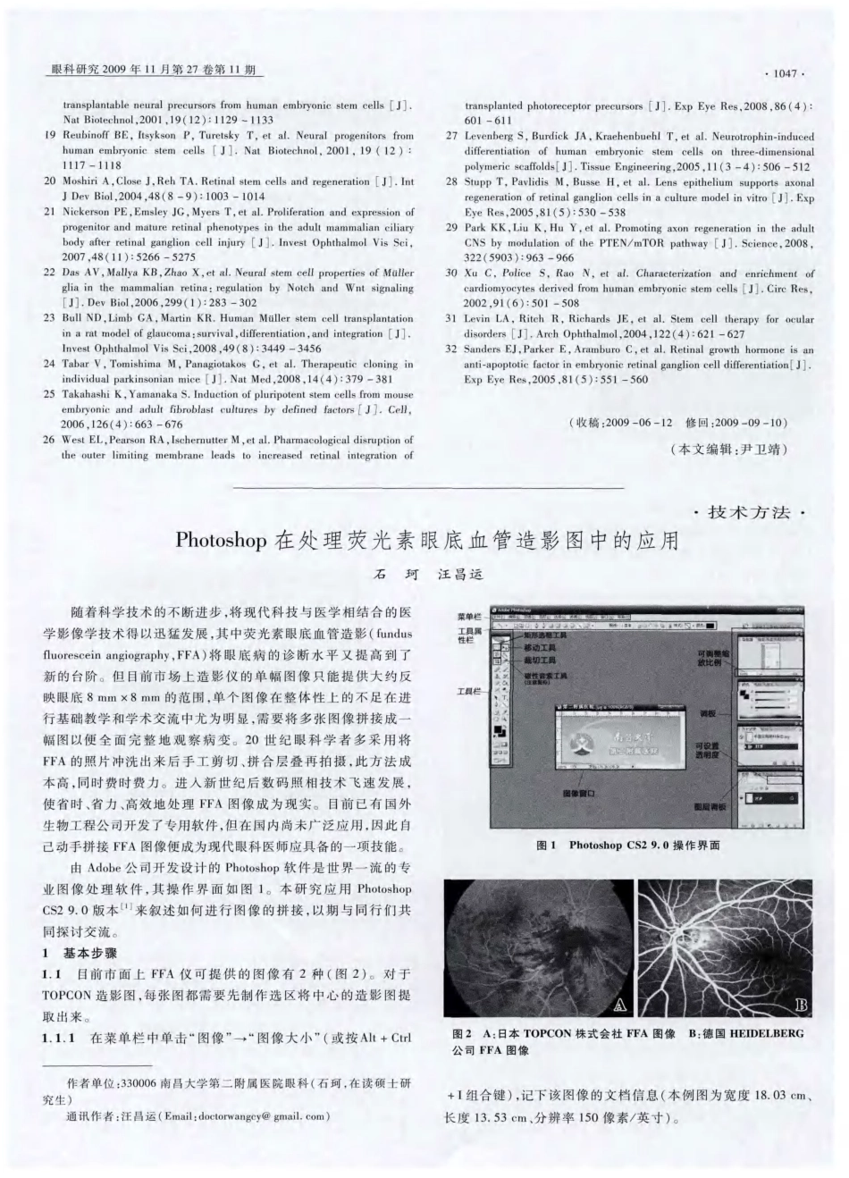 Photoshop在处理荧光素眼底血管造影图中的应用_第1页