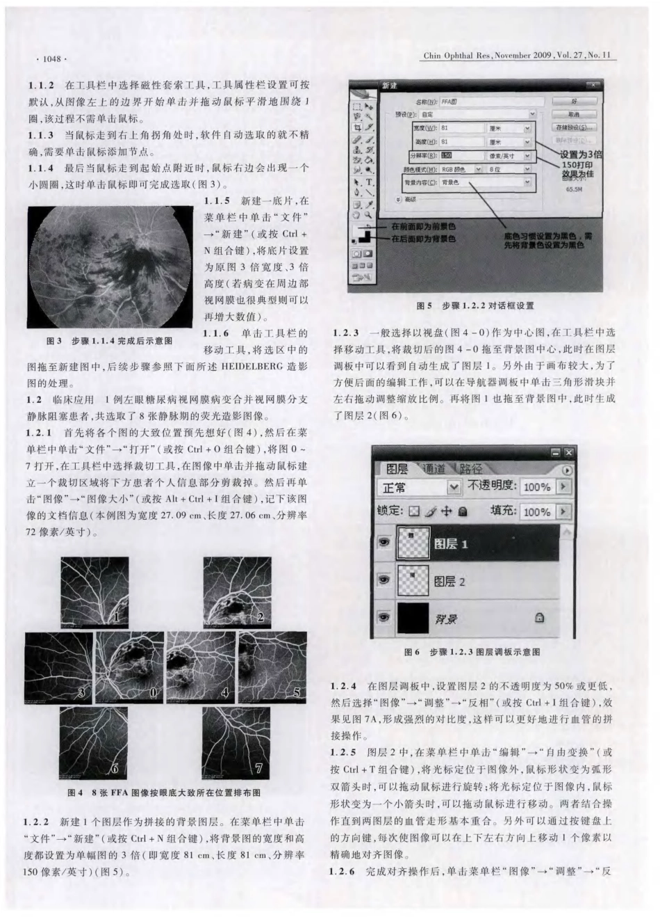 Photoshop在处理荧光素眼底血管造影图中的应用_第2页