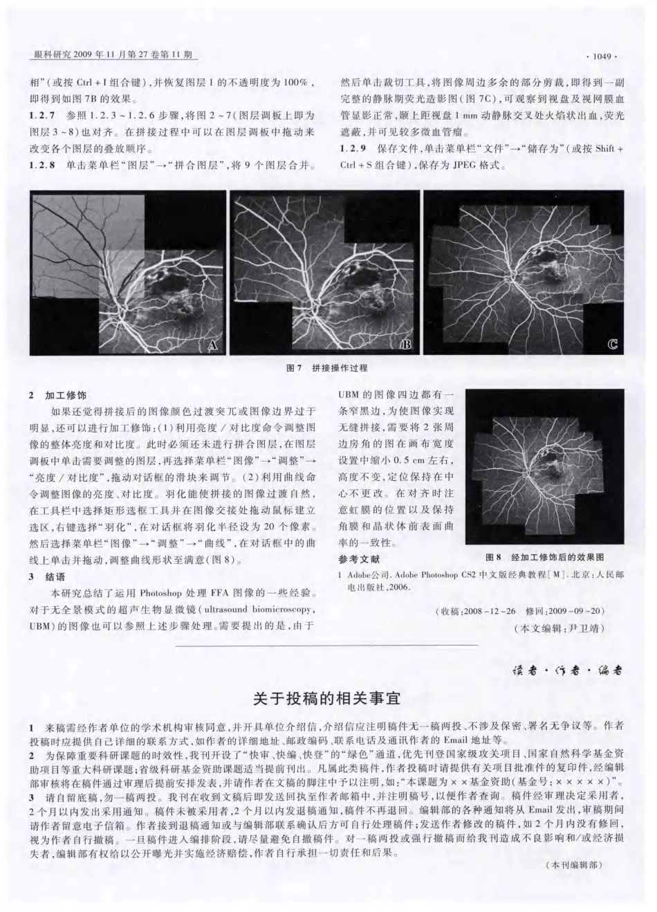 Photoshop在处理荧光素眼底血管造影图中的应用_第3页