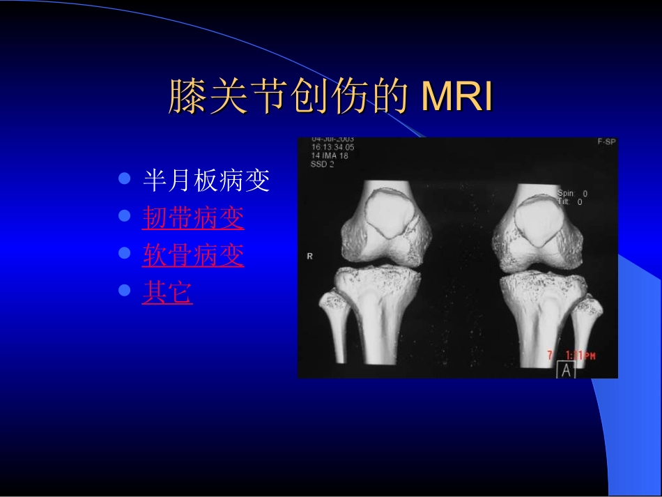 MRI膝关节_第2页