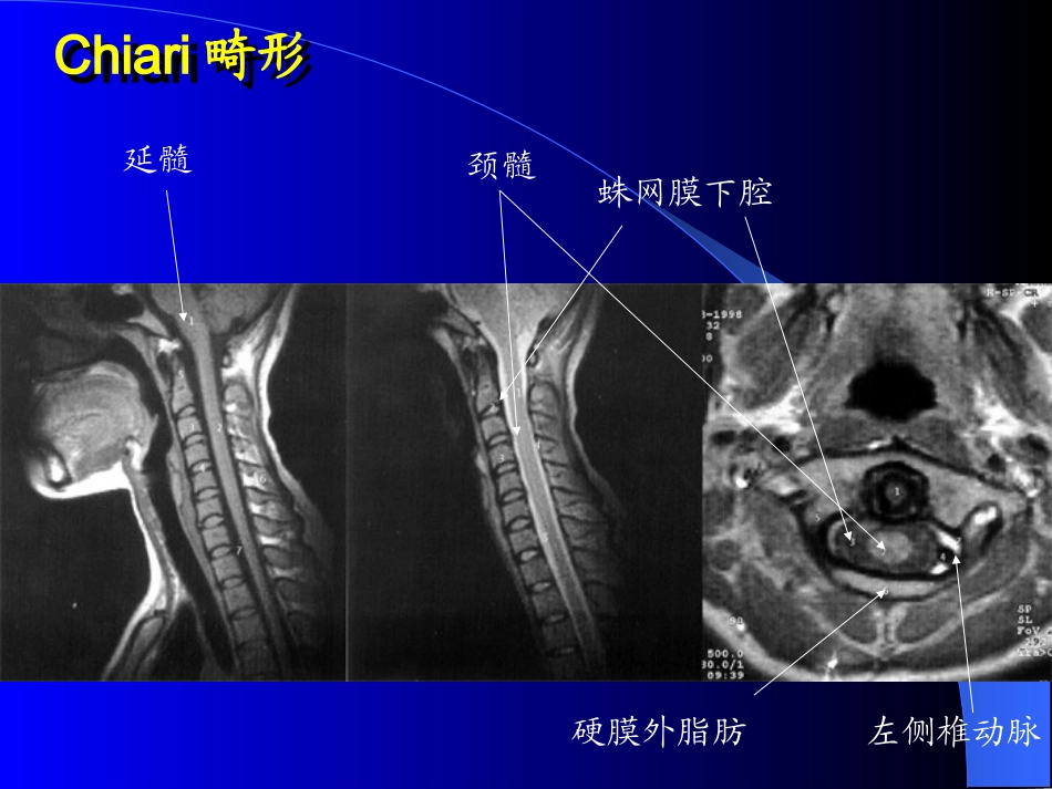 MRI图像-脑-01_第1页