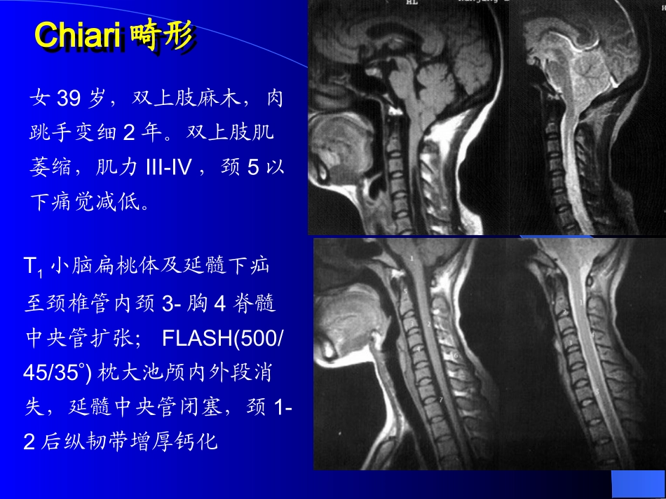 MRI图像-脑-01_第2页