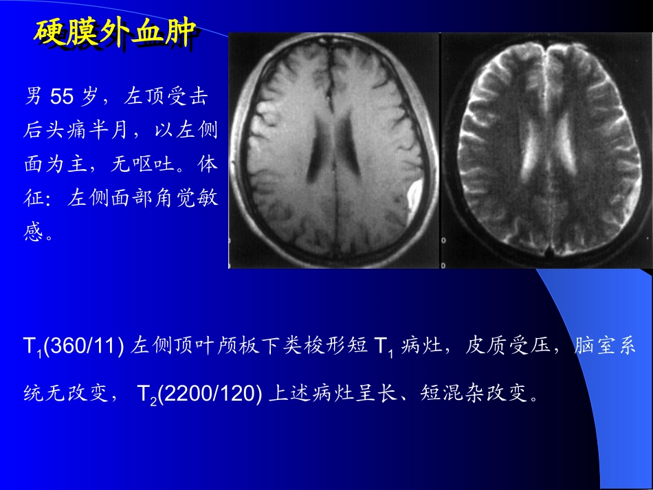 MRI图像-脑-01_第3页