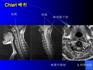 MRI图像-脑-01