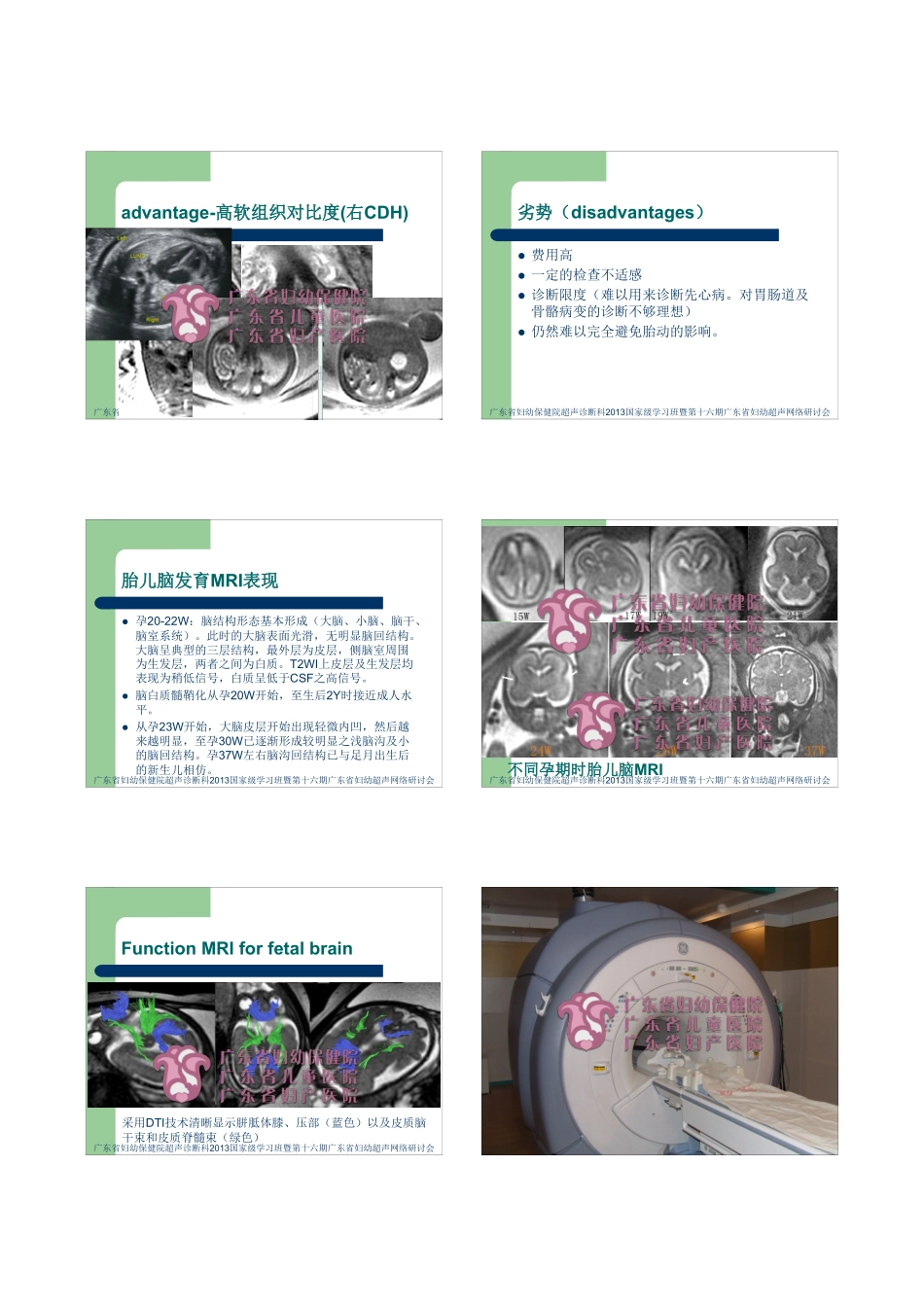 MRI在胎儿颅脑疾病诊断中的应用_第2页