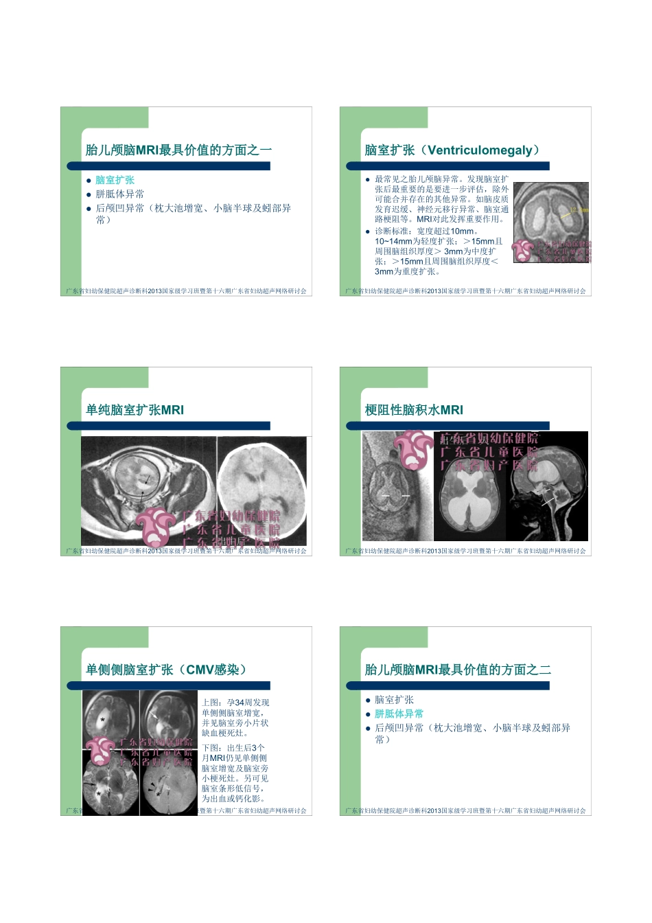 MRI在胎儿颅脑疾病诊断中的应用_第3页