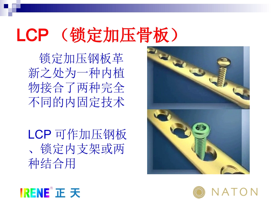 LCP系统接骨板的注意问题及常见问题(免金币)_第2页