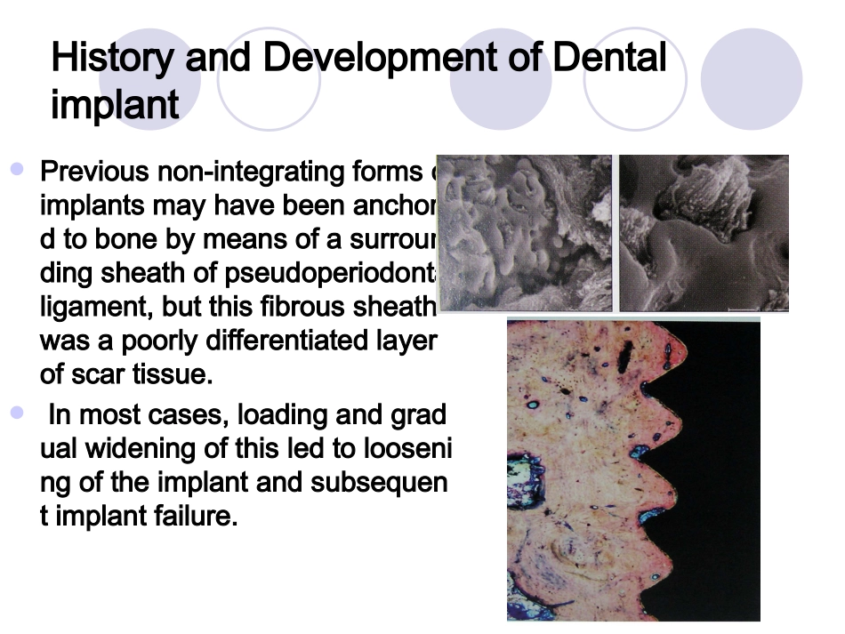 implant-history-and-development-口腔种植_第1页