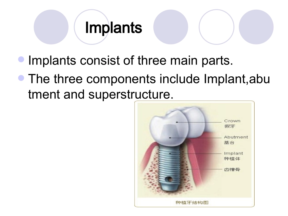 implant-history-and-development-口腔种植_第2页