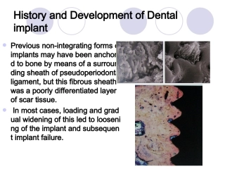implant-history-and-development-口腔种植