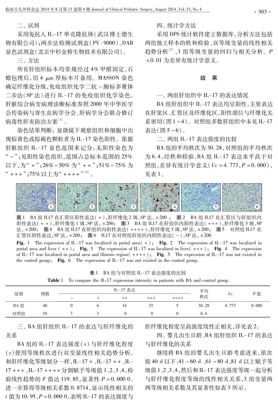 IL-17在胆道闭锁患儿肝组织中的表达及意义_第2页