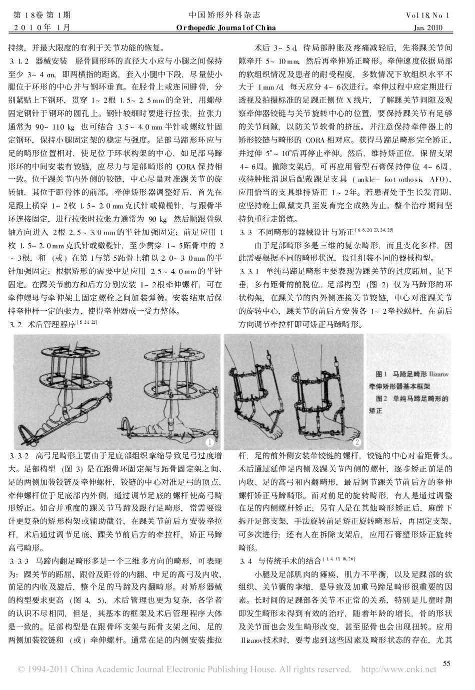 Ilizarov技术矫治马蹄足畸形的临床应用进展_第3页