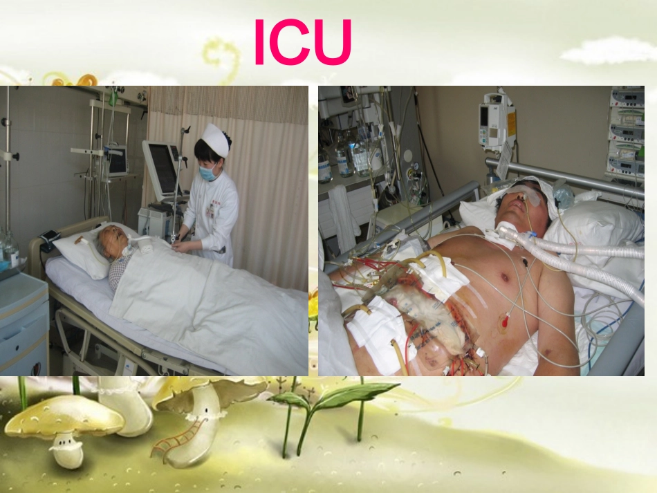 ICU镇痛镇静及谵妄防治_第2页