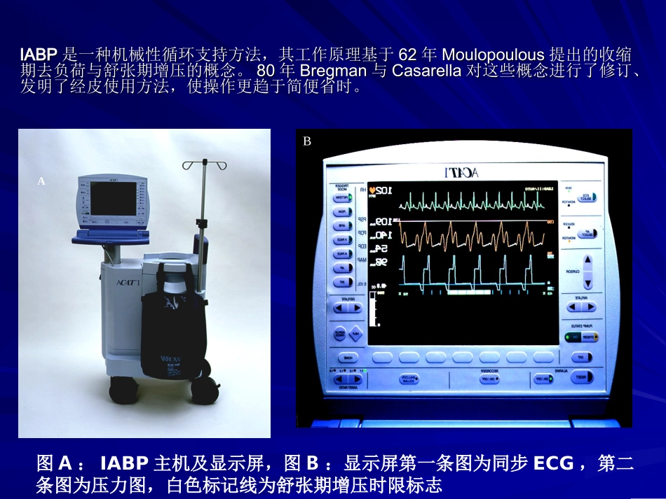 IABP-安贞医院_第2页