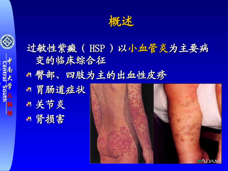 HSP诊治进展_第3页