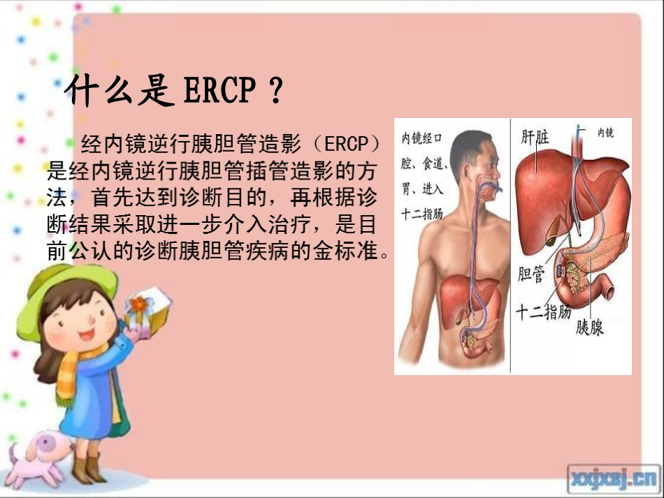 ERCP术中配合_第3页