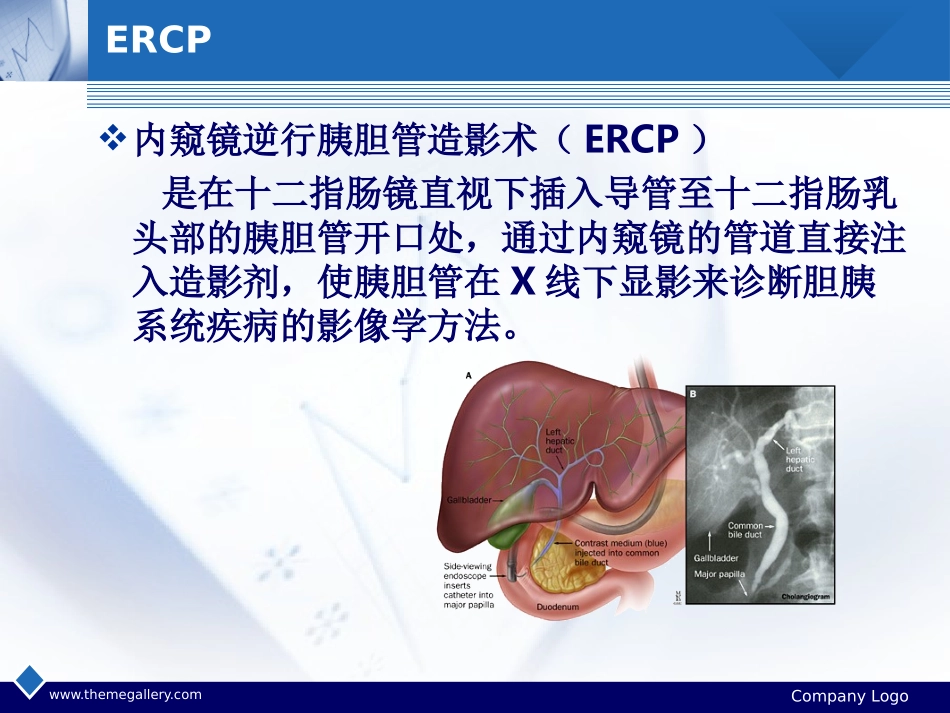 ERCP诊疗与并发症_第2页