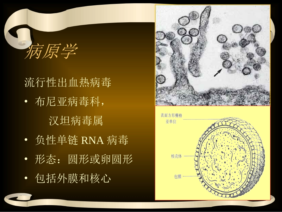 EHF-流行性出血热_第3页
