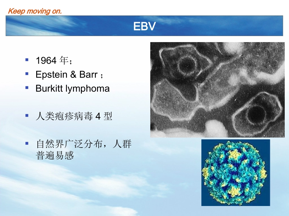 EBV及传染性单核细胞增多症_第3页