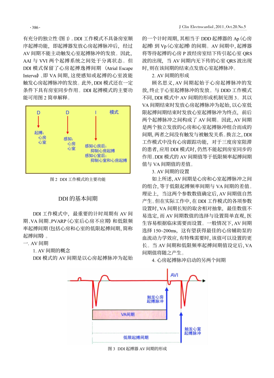 DDI起搏心电图_第2页