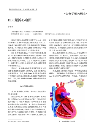 DDI起搏心电图