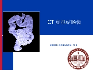 CT虚拟结肠镜