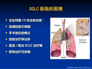 CSCO小细胞肺癌