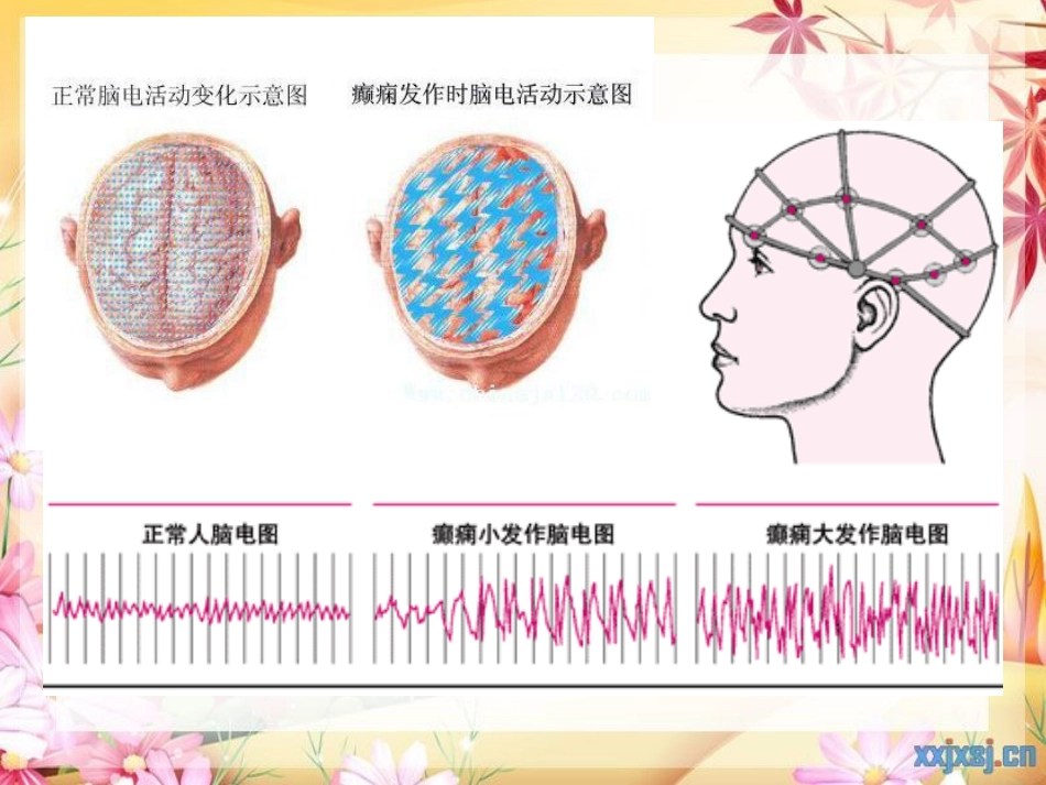 cq13-抗癫痫、抗惊厥药解读_第3页