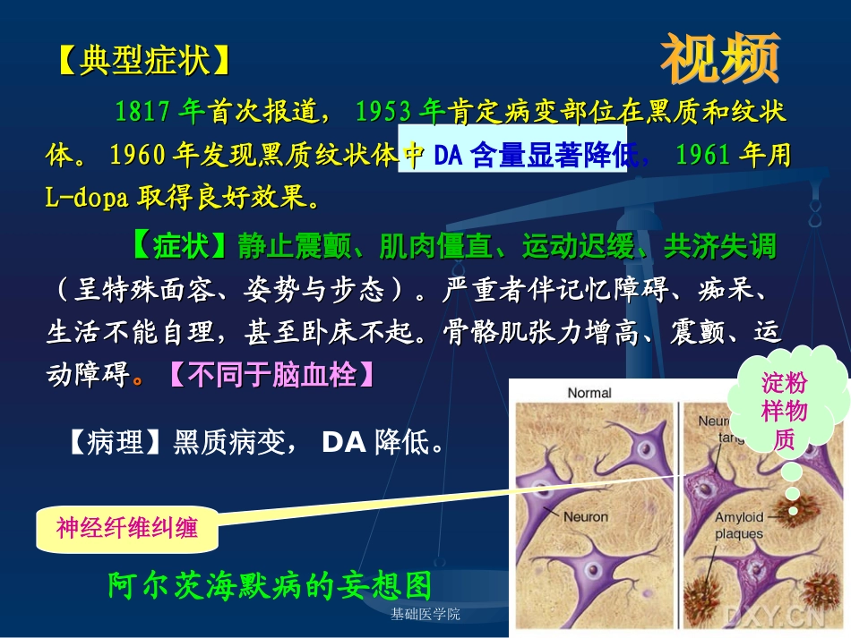 cq抗帕金森病解读_第3页