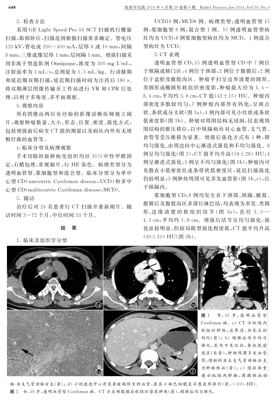 Castleman病的CT表现及临床病理特点_第2页