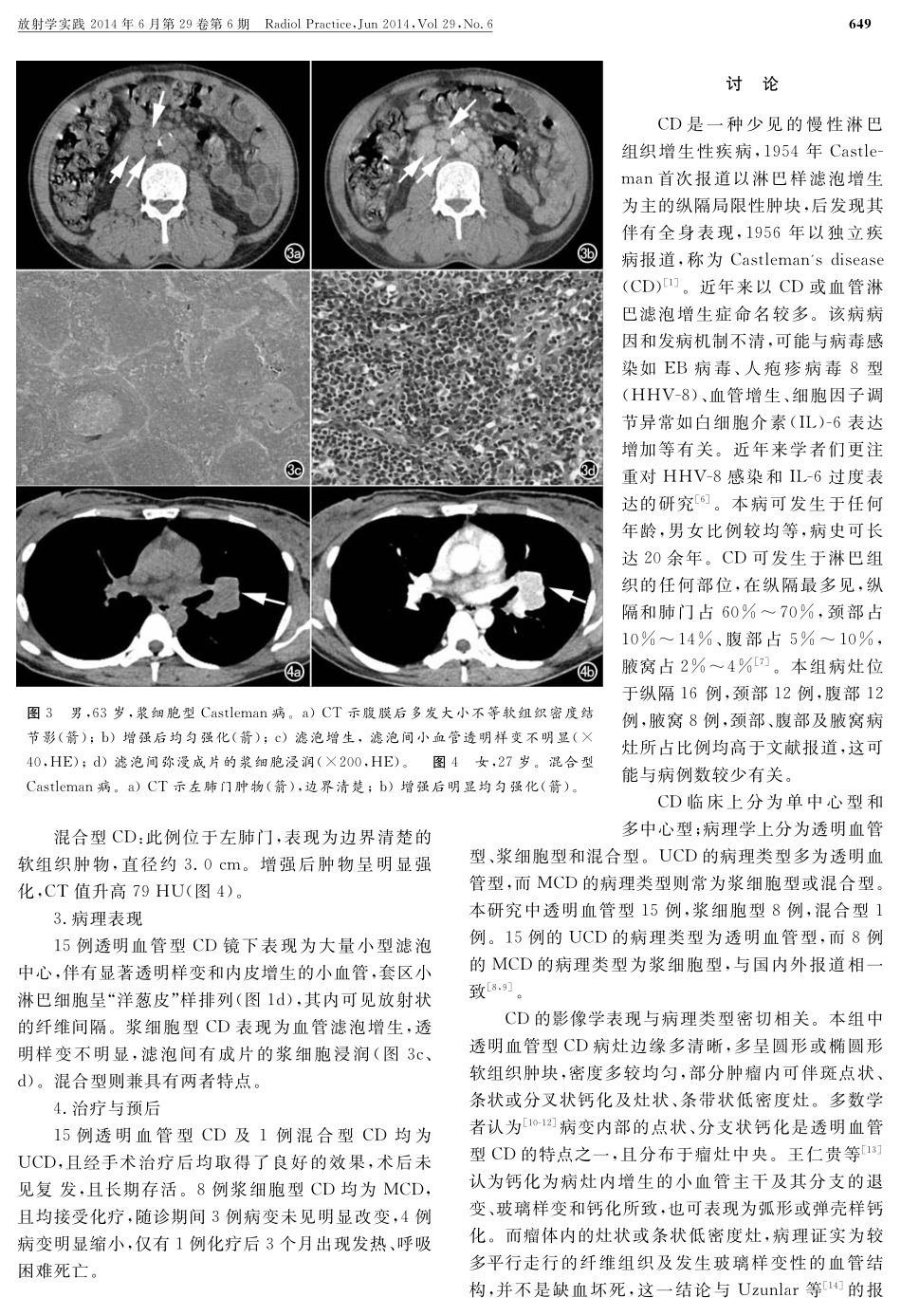 Castleman病的CT表现及临床病理特点_第3页
